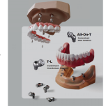 Exclusive Custom Abutments