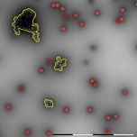 QuTEM - Adenoviral vector analysis