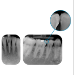 Durr VistaScan MiniView