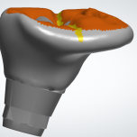 Exclusive Custom Abutments