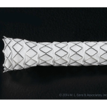 GORE® VIABAHN® VBX Balloon Expandable Endoprosthesis