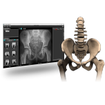 Biomedica X1 A1 Bone Densitometer Solution