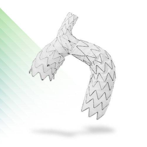 NEXUS Aortic Arch Stent Graft System by Endospan