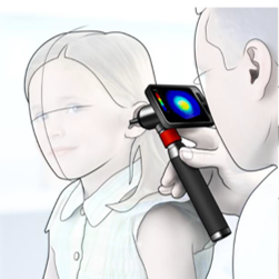 3D tympanoscoop as novel instrument for real-time analysis of eardrum deformations