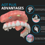 Exclusive Custom Abutments