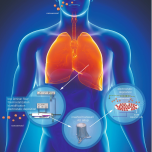 AIR-LIQUID INTERFACE (ALI) technology: bridge the gap between pre-clinical and clinical trials