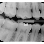 Durr VistaScan MiniView