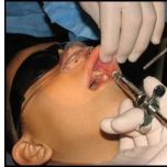 Silhouette Low Profile Mask - 4 sizes - Includes the Smallest Nasal Mask in the World