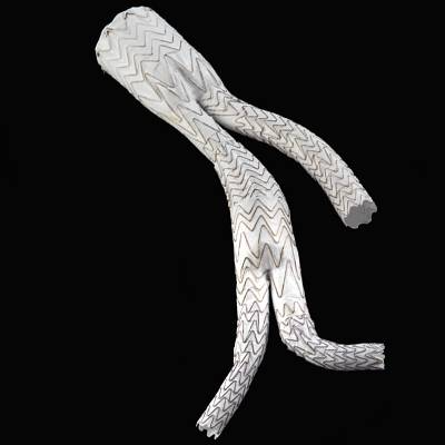 GORE® EXCLUDER® Iliac Branch Endoprosthesis
