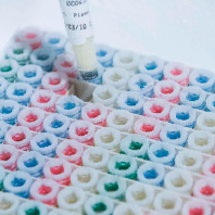 Biomarker discovery & IP opportunities