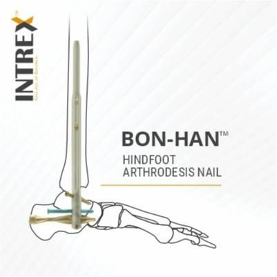Intrex - Strength & Accuracy in Internal Fixation