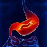 HELICOBACTER PYLORI Ag VIRCLIA® MONOTEST