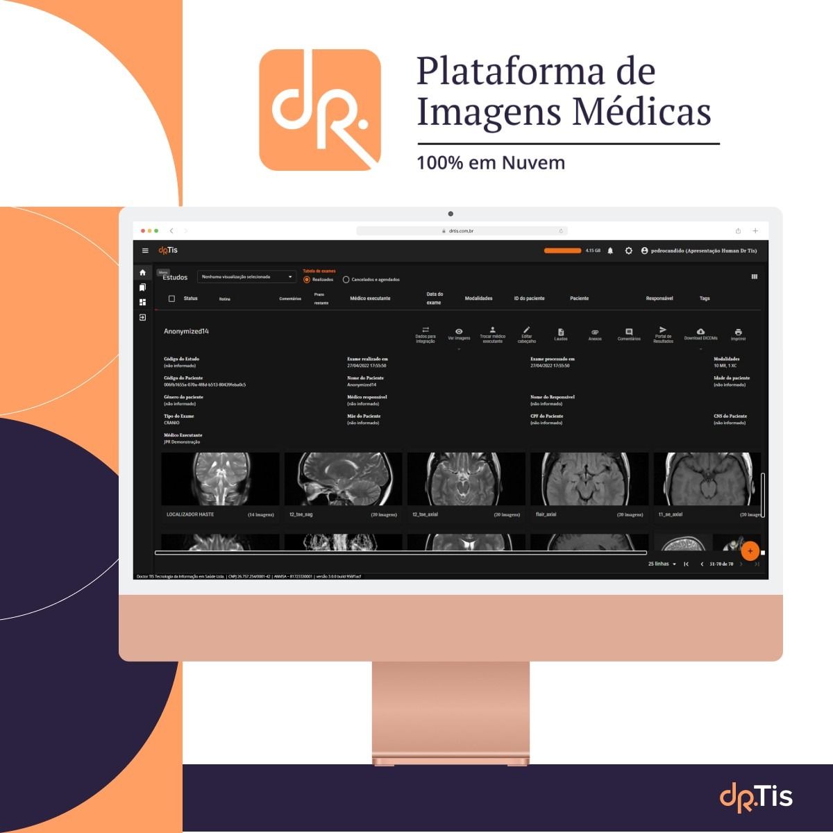 Plataforma de Imagens Médicas - PACS 100% em Nuvem