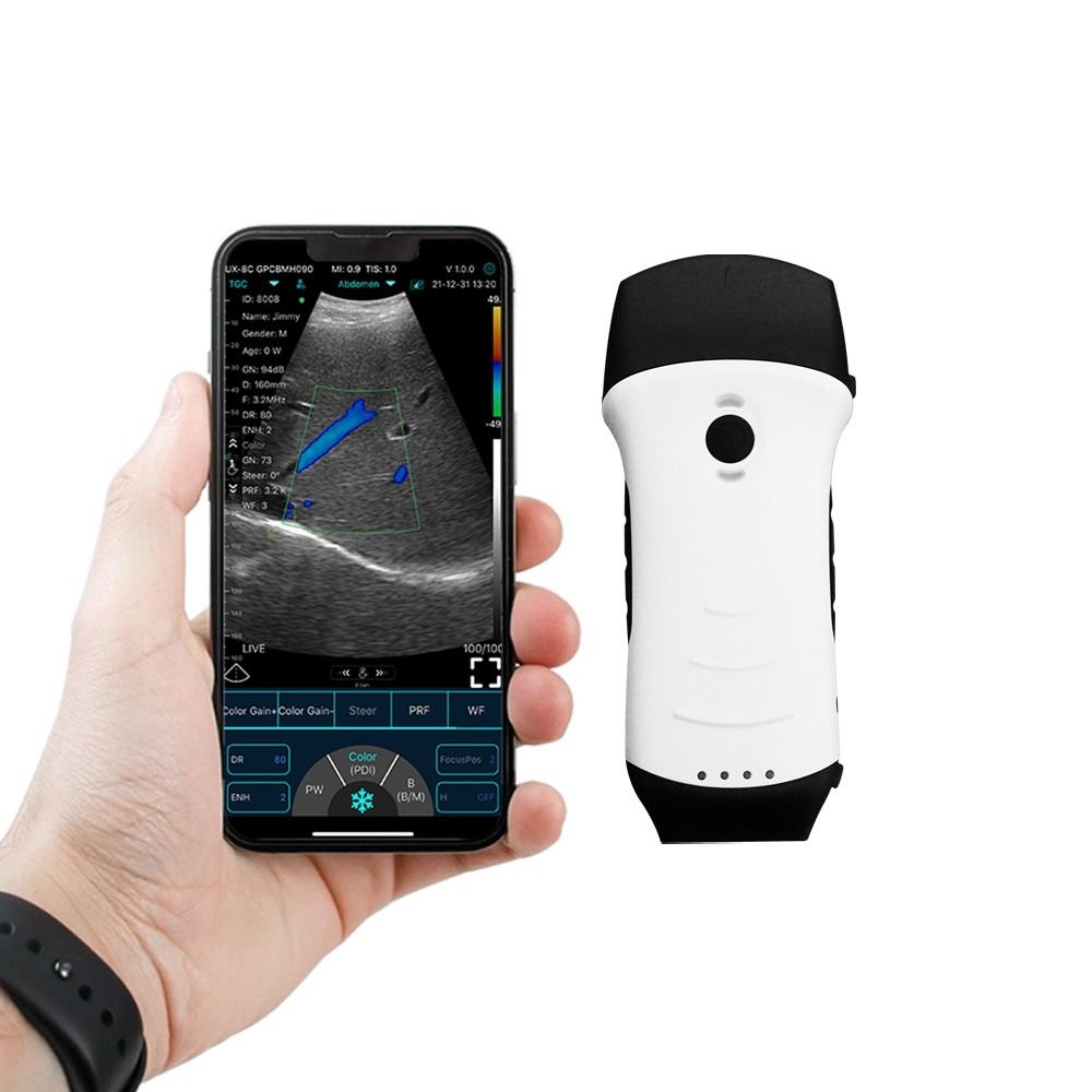 C10TX New Dual-probes Multipurpose wireless Ultrasound Convex +linear+ Cardiac Probe,handheld ultrasound scanner with MDR CE FDA approved ,for IOS, Android, Windows Device