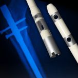 Subiton NAIL - ANTIBIOTIC COATED INTRA-MEDULLARY NAIL