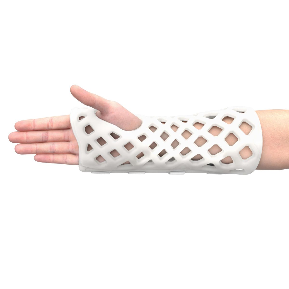 A shower-friendly odor and itch free orthopedic cast allows for skin monitoring and quick to apply