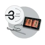 Single-use Digital Cystoscope