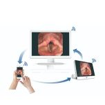 wireless video nasopharyngoscope 2.0mm for ENT from Mindsion