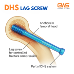 Orthopedic & Headless Cannulated Screws