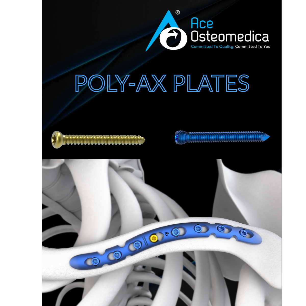VARIABLE ANGLED LOCKING PLATES