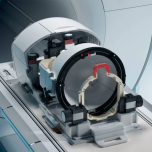 Exablate® Neuro | Insightec