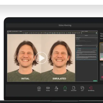 Invisalign Smile Video
