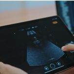 AI Agents in Healthcare