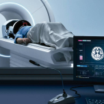 Exablate® Neuro | Insightec