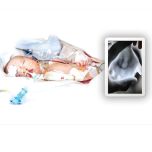 Adison 3D Liquid Crystal Vein Locator