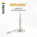 INTREX - Intramedullary Nail Systems for Rapid, Reliable Recovery