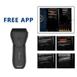C10 MX Pro: Advanced Wireless Pocket Ultrasound for Skin Aesthetics - Dual Battery, IP68 Waterproof, Anti-Slip Design, High-Definition Imaging & Portable Diagnosis Solution