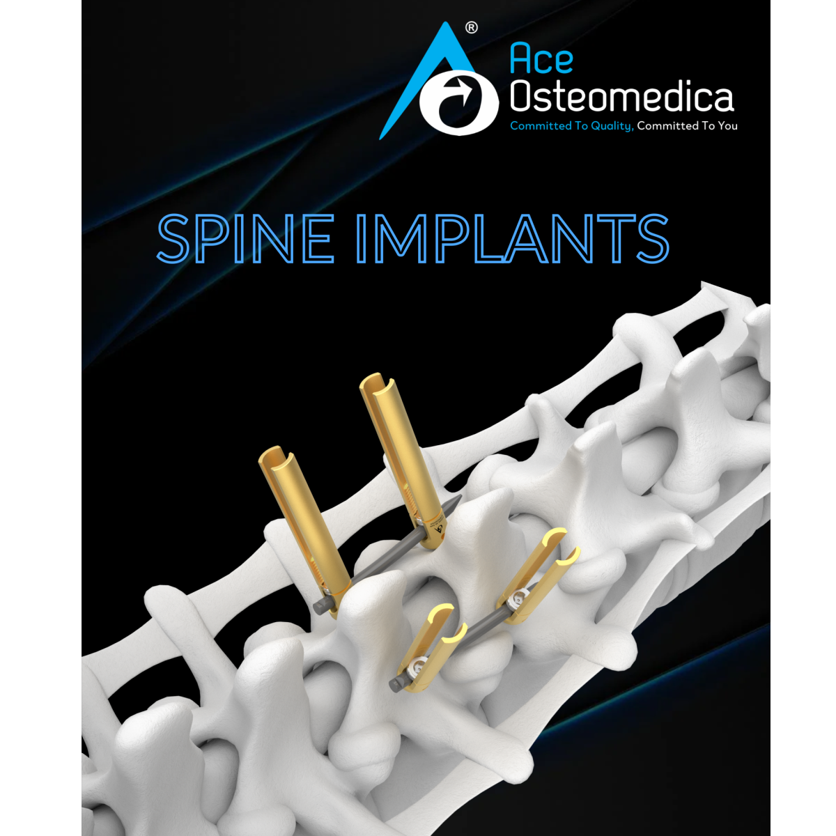 SPINE IMPLANTS