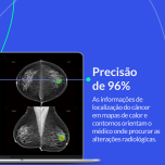 Inteligência Artificial na detecção do câncer de mama e de tórax | Lunit