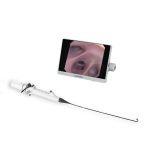 wireless digital video bronchoscope from MINDSION