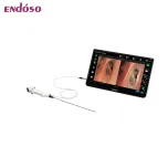 Single-use Digital Choledochoscope