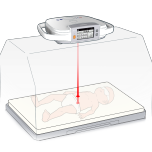 Incubadora - B3/B6/B8 + Equipamento de fototerapia - BL70