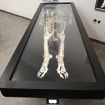 HD Digihuman Virtual Anatomy Table