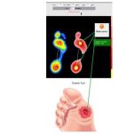 Pressure Plates / Baropodometric platfoms for Physiotherapy, Orthopedic, Diabete, Sports