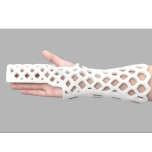 A shower-friendly odor and itch free orthopedic cast allows for skin monitoring and quick to apply