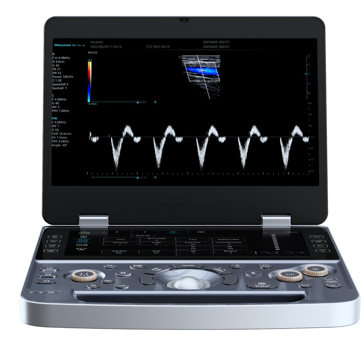 Aisense Series Portable Color Doppler Ultrasound