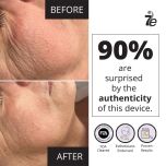 MyoLift Mini Microcurrent Facial Device - Non-Invasive Face Lift, Facial Skin Care Products for Anti Aging, Skin Tightening - Esthetician Supplies and Skin Care Tools - Up to 400 Microamps