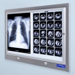 X-ray film viewers - negatoscopes LED-NGP series | recessed X-ray film viewers LED-NGP-WS series for operating rooms LED-NGP series -