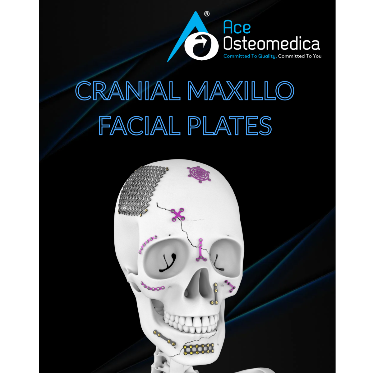 CRANIO-MAXILLOFACIAL IMPLANTS