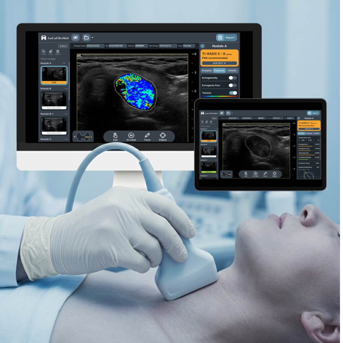 AmCAD-UT, Real-time AI-assisted Thyroid Ultrasound Assessment