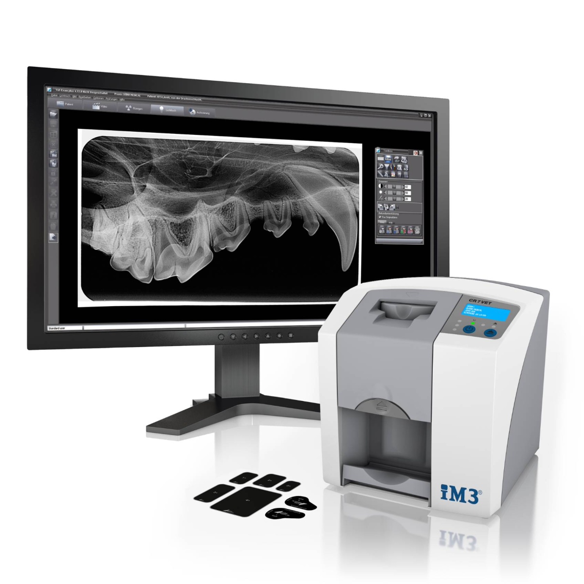 Im3 Dental X Ray Im3 Dental X Ray